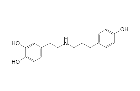 Dobutamine artifact