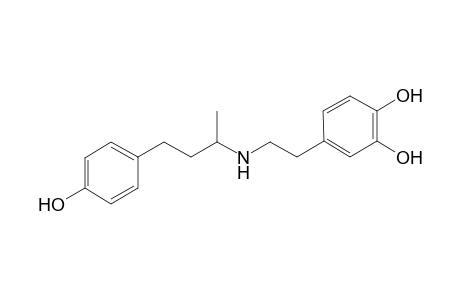 Dobutamine artifact