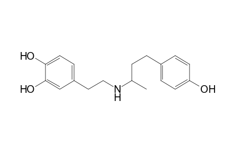 Dobutamine artifact