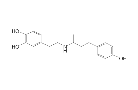 Dobutamine artifact