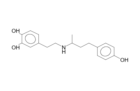 Dobutamine artifact